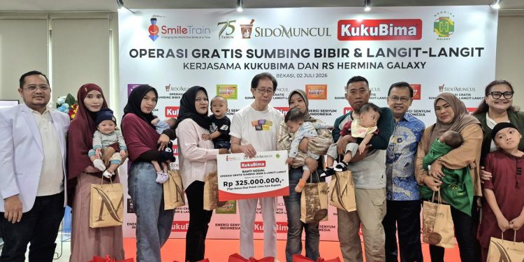 Kuku Bima dan Tolak Angin Salurkan Bantuan Rp325 Juta untuk Operasi Gratis Sumbing Bibir