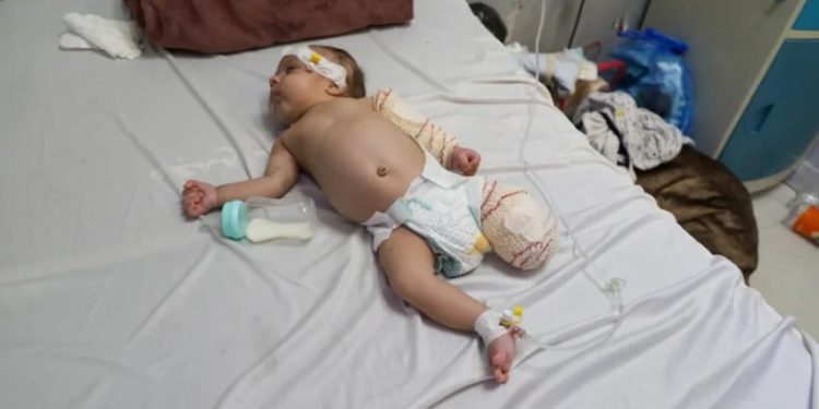 1.022 Bayi dari 21.500 Anak Tewas Selama Genosida 1.000 Hari di Gaza