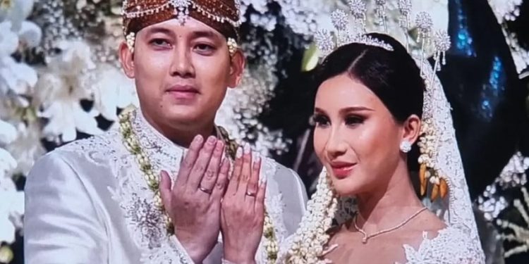 Profil Chika Yenalovy Istri Rizky Irmansyah yang Sedang Jadi Sorotan