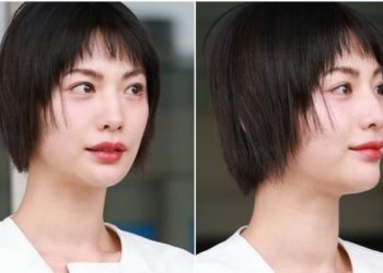 Nana Berubah dengan Bibir Lebih Tipis Setelah Kontroversi di The Scandal