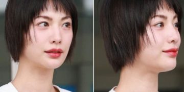Nana Berubah dengan Bibir Lebih Tipis Setelah Kontroversi di The Scandal