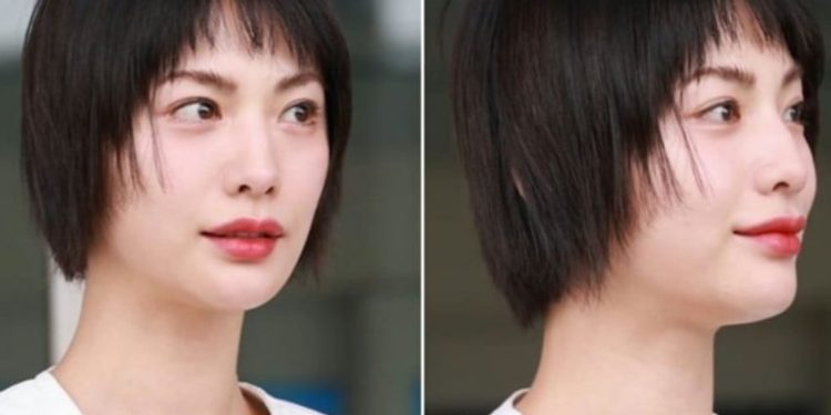 Nana Berubah dengan Bibir Lebih Tipis Setelah Kontroversi di The Scandal